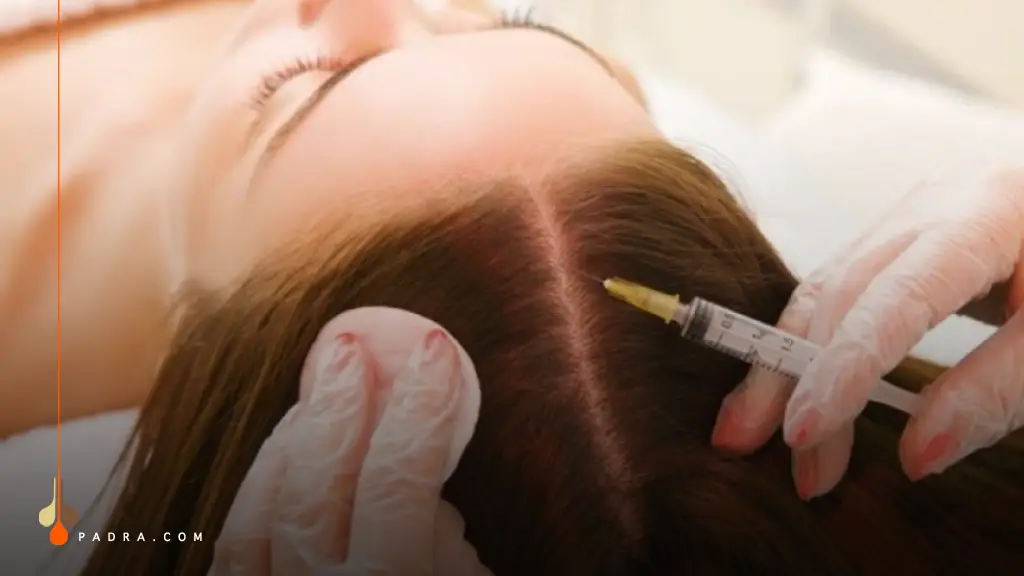 How Does Mesotherapy Hair Treatment Work?