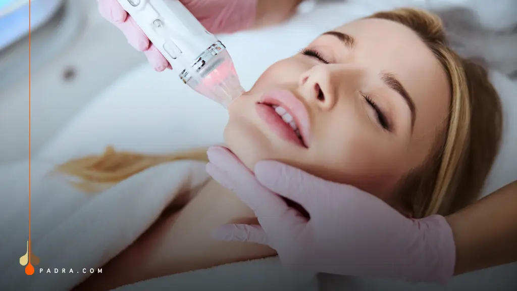  RF Microneedling