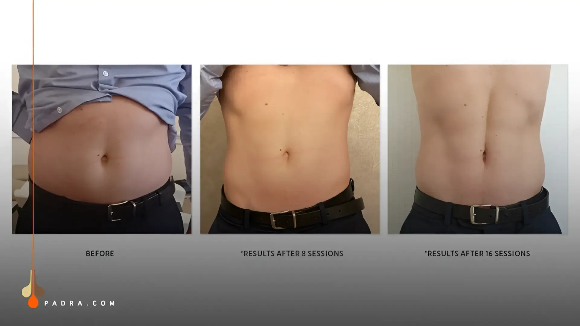 tesla former muscle toning before and after
