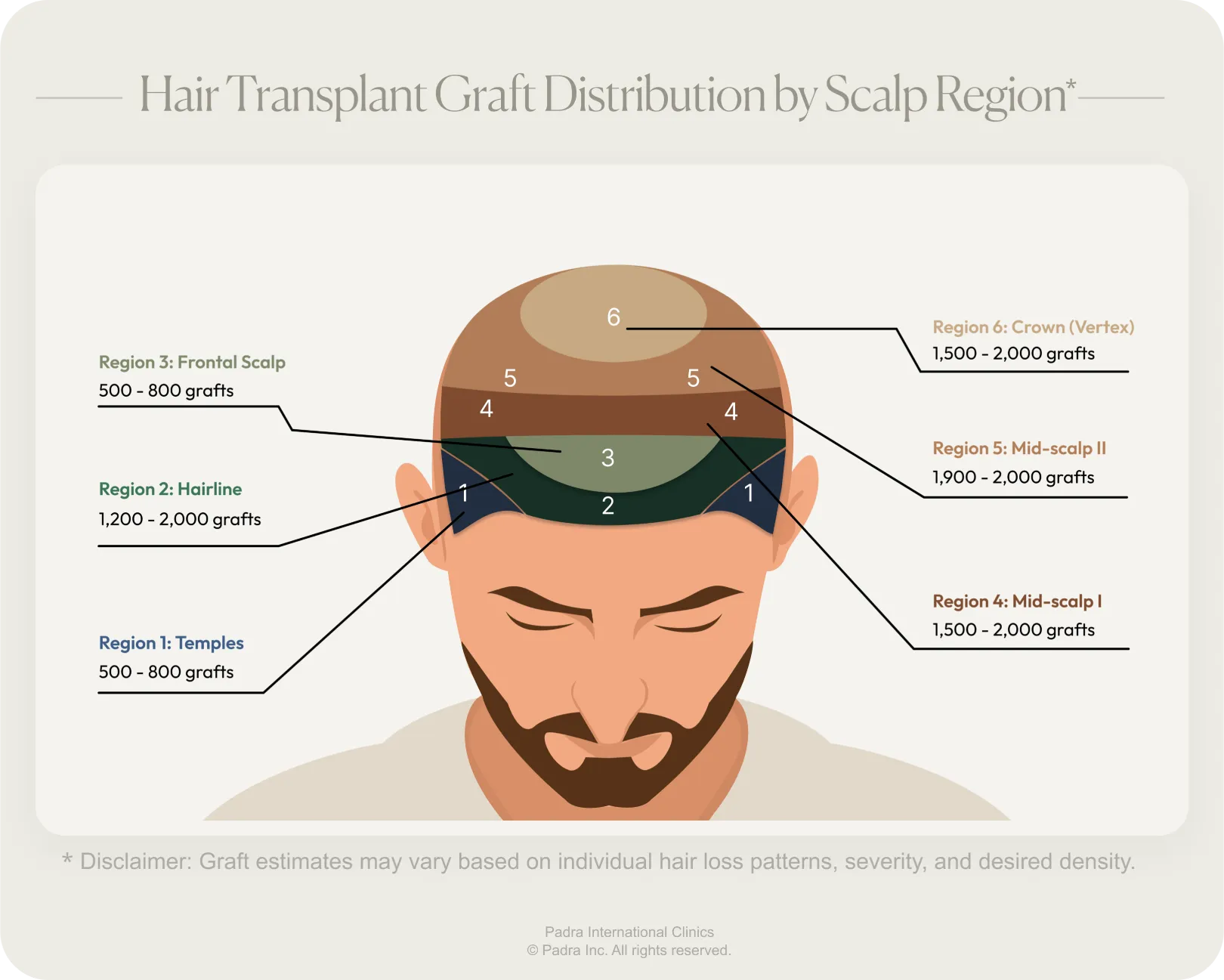 hair graft distribution by scalp regions