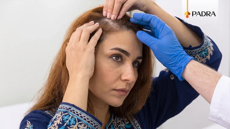 استشارة زراعة الشعر بالخلايا الجذعية